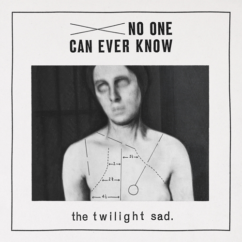 Interview – The Twilight&nbsp;Sad